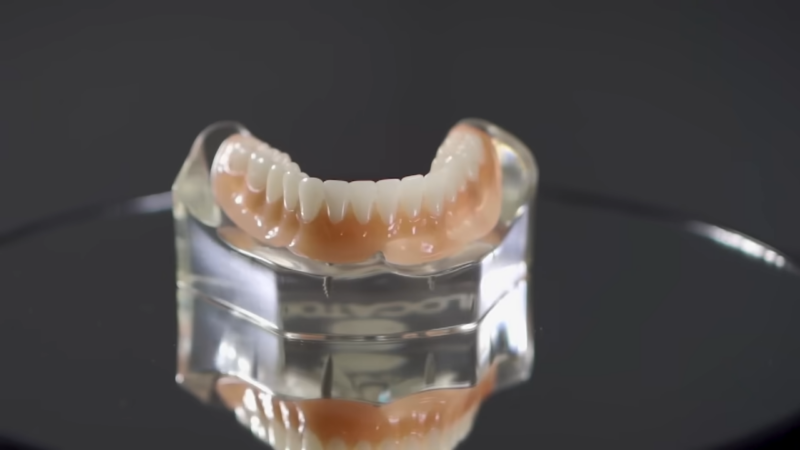 A Set of Full-Mouth Dental Implants Displayed on A Stand