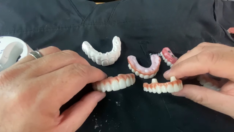 A Person Handling Various Types of Dental Implants on A Surface