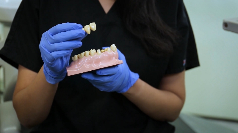 Dental model with a bridge held by a gloved dental professional