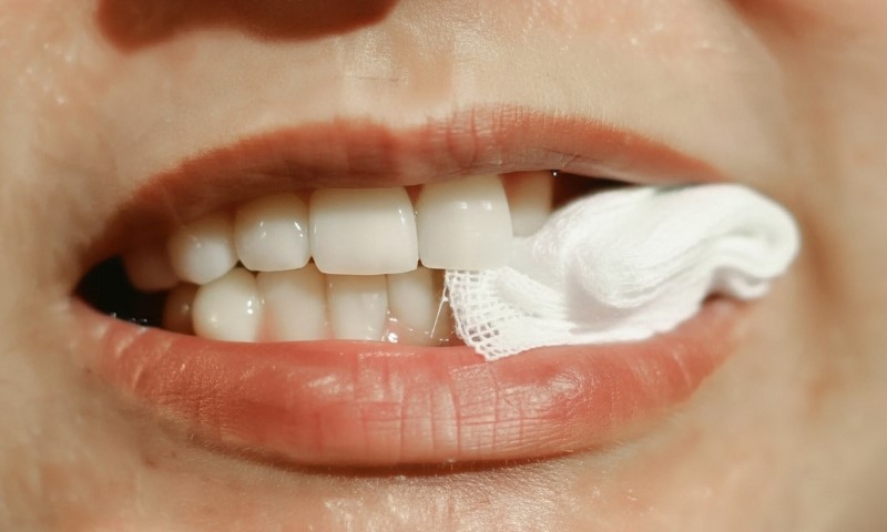 Close-up of a person's mouth with bright white teeth, holding a white gauze between the lips
